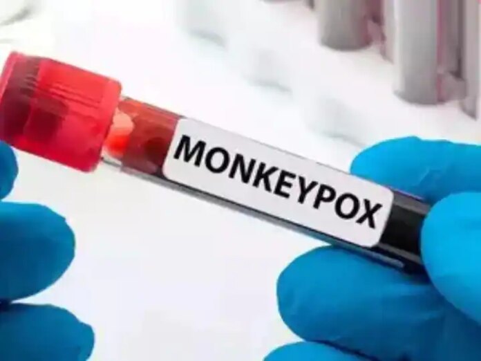 Biden Administration Expected To Soon Declare Monkeypox A Public Health...
