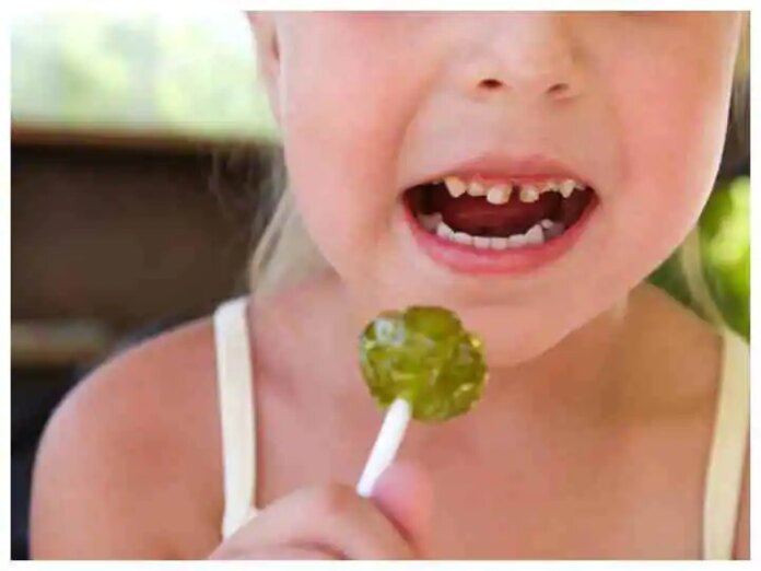 Parenting Tips : कैंडी और चॉकलेट से बच्चों के दांतों में लग गए हैं कीड़े?...