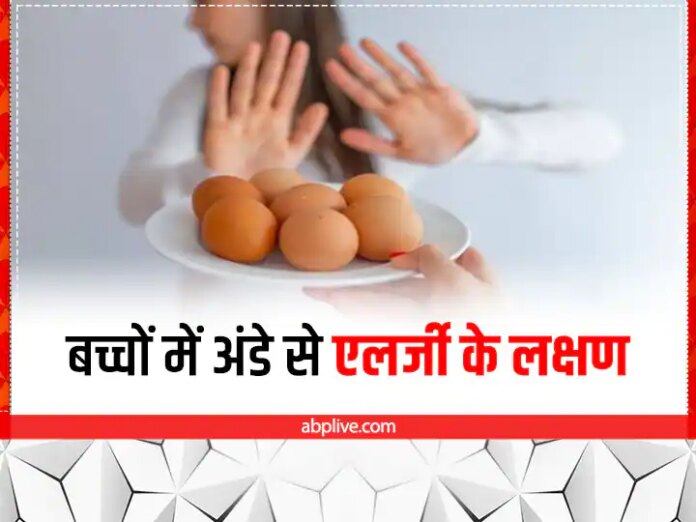 Symptoms Of Egg Intolerance Egg Allergy Treatment In Children Egg Allergy In...