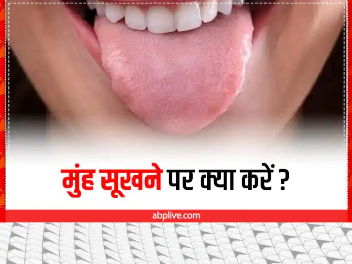What Is The Fastest Way To Cure Dry Mouth