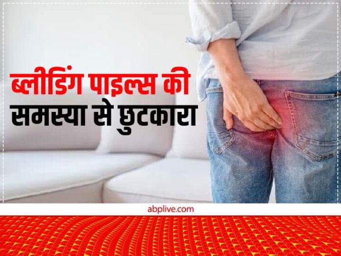 Health Tips Bleeding Piles Get Rid Of These Home Remedies