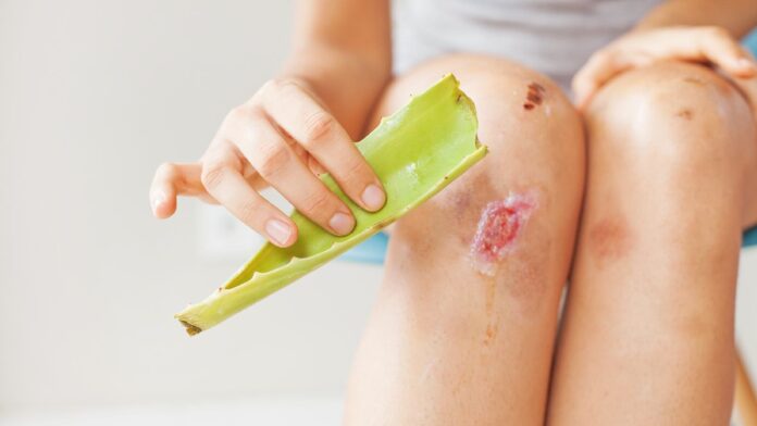 8 ways to heal wounds faster